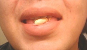 Seeds