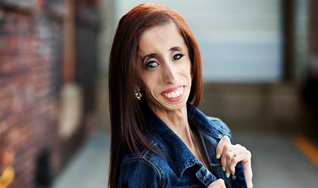 Image result for lizzie velasquez